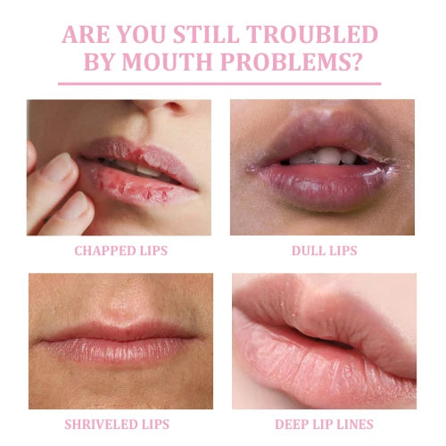 Jaysuing Exfoliating Scrub Lighten Lines  Remove Dead Skin And Moisturizing Treatment Lip Mask