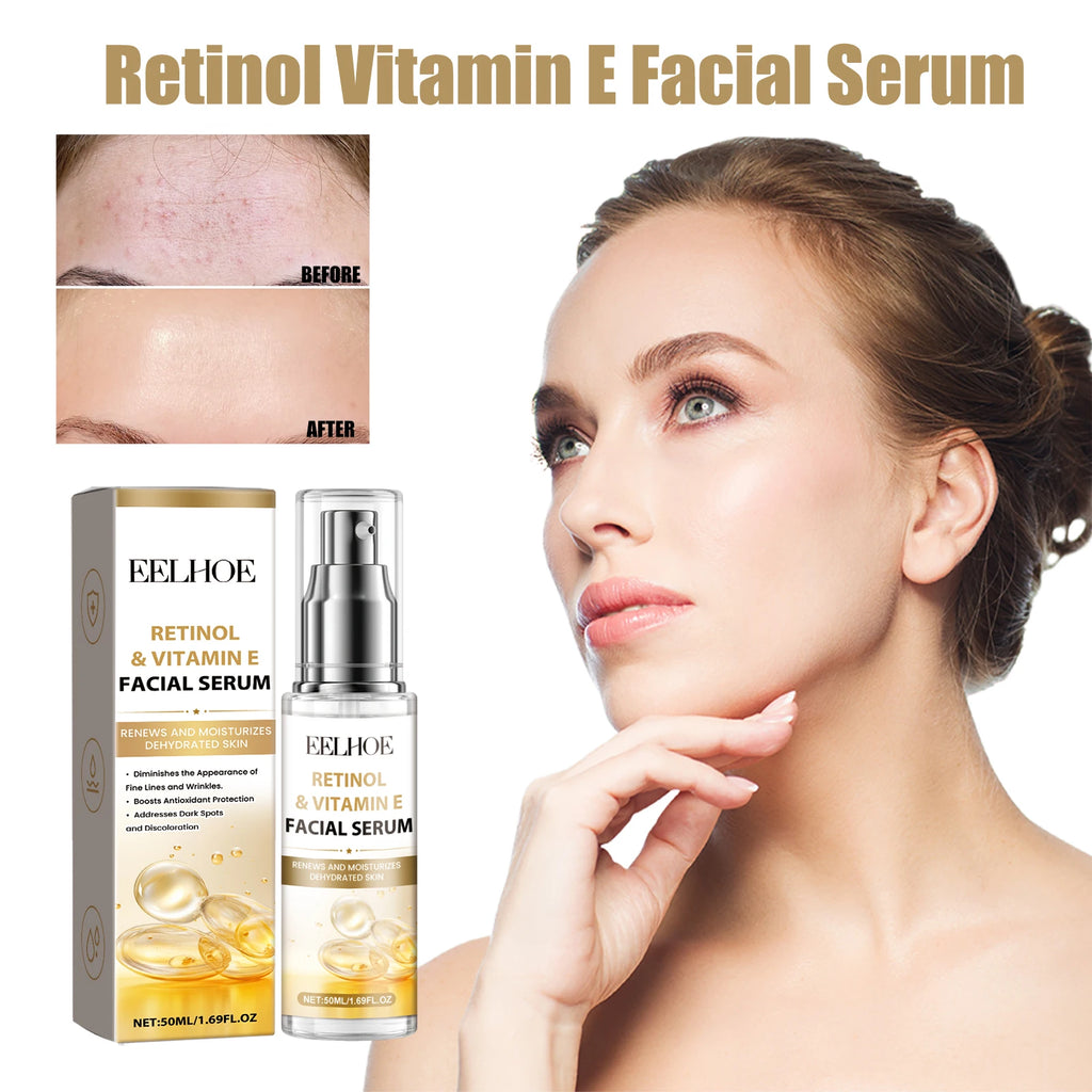 Eelhoe Retinol E Night Facial Essence, Brightening Skin, Moisturizing And Hydrating Essence