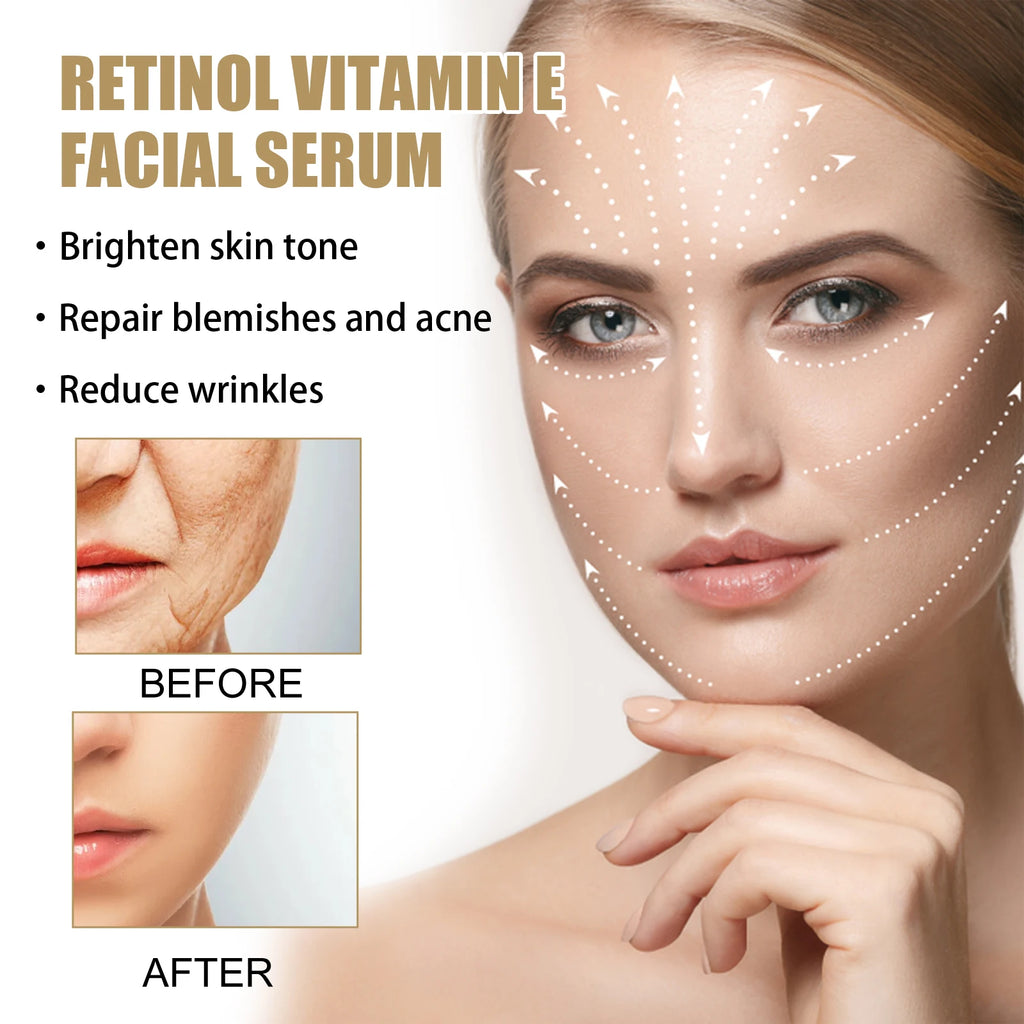 Eelhoe Retinol E Night Facial Essence, Brightening Skin, Moisturizing And Hydrating Essence
